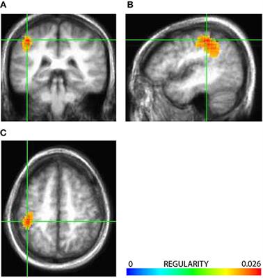 Dominant Patterns of Information Flow in the Propagation of the Neuromagnetic Somatosensory Steady-State Response